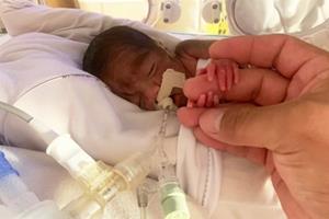 Premature baby born 18 weeks early joins her family for Christmas